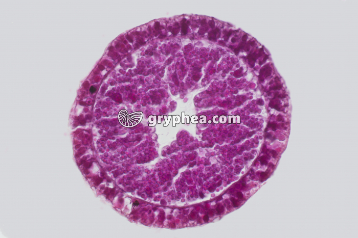 Hydre CT x25 - gryphea.org